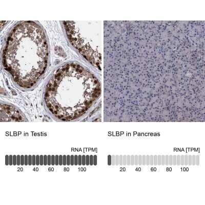 <b>Independent Antibodies Validation and Orthogonal Strategies Validation.</b>Immunohistochemistry-Paraffin: SLBP Antibody [NBP1-83290] - Staining in human testis and pancreas tissues using NBP1-83290 antibody. Corresponding SLBP RNA-seq data are presented for the same tissues.