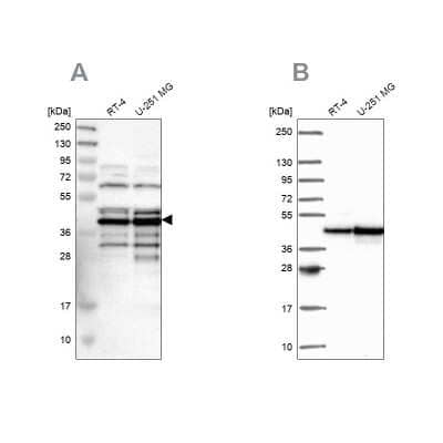 Western Blot SLBP Antibody - BSA Free