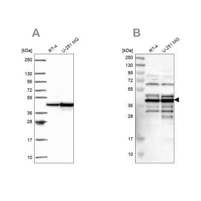 Western Blot: SLBP Antibody [NBP2-56007] - Analysis using Anti-SLBP antibody NBP2-56007 (A) shows similar pattern to independent antibody NBP1-83290 (B).