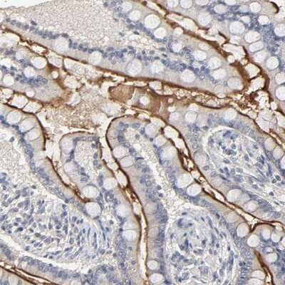 Immunohistochemistry-Paraffin: SLC10A2 Antibody [NBP1-88813] - Staining of human small intestine shows strong membranous positivity in glandular cells.