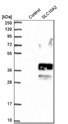 Western Blot: SLC10A2 Antibody [NBP1-88813] - Analysis in control (vector only transfected HEK293T lysate) and sLC10A2 over-expression lysate (Co-expressed with a C-terminal myc-DDK tag (3.1 kDa) in mammalian HEK293T cells).