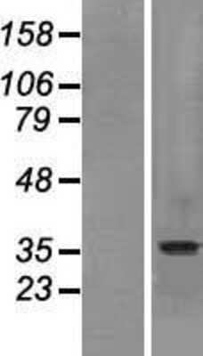 Western Blot: SLC10A2 Overexpression Lysate (Adult Normal) [NBP2-09028] Left-Empty vector transfected control cell lysate (HEK293 cell lysate); Right -Over-expression Lysate for SLC10A2.