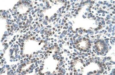 Immunohistochemistry-Paraffin: SLC10A5 Antibody [NBP1-59707] - Human Lung Alveolar cells (indicated with arrows), 4-8ug/ml.