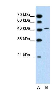 Western Blot: SLC10A5 Antibody [NBP1-59707] - Titration: 1.25ug/ml Positive Control: Jurkat cell lysate.