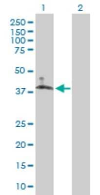 Western Blot: SLC10A6 Antibody [H00345274-B01P] - Analysis of SLC10A6 expression in transfected 293T cell line by SLC10A6 polyclonal antibody.  Lane 1: SLC10A6 transfected lysate(41.47 KDa). Lane 2: Non-transfected lysate.