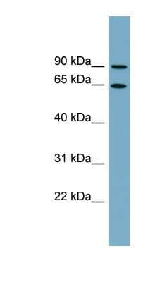 Western Blot: SLC12A8 Antibody [NBP1-59893] - THP-1 cell lysate, concentration 0.2-1 ug/ml.