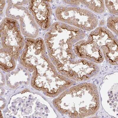 Immunohistochemistry: SLC13A1 Antibody [NBP2-38970] - Staining of human kidney shows moderate membranous and cytoplasmic positivity in cells in tubules.