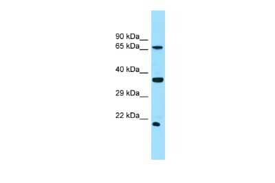 Western Blot: SLC13A1 Antibody [NBP2-85735] - WB Suggested Anti-SLC13A1 Antibody. Titration: 1.0 ug/ml. Positive Control: THP-1 Whole Cell