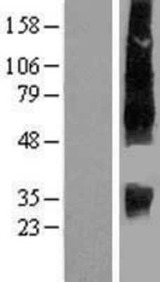 Western Blot: SLC13A2 Overexpression Lysate (Adult Normal) [NBP2-07930] Left-Empty vector transfected control cell lysate (HEK293 cell lysate); Right -Over-expression Lysate for SLC13A2.