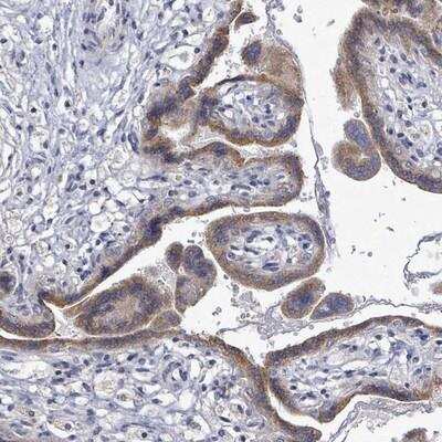 Immunohistochemistry-Paraffin: SLC13A4 Antibody [NBP2-13313] - Staining of human placenta shows moderate cytoplasmic positivity in trophoblastic cells.