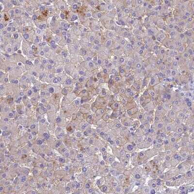 Immunohistochemistry-Paraffin SLC13A5 Antibody