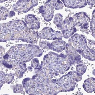 Immunohistochemistry-Paraffin SLC13A5 Antibody