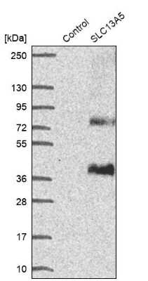 Western Blot SLC13A5 Antibody