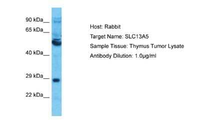 Western Blot: SLC13A5 Antibody [NBP2-85736] - Host: Rabbit. Target Name: SLC13A5. Sample Type: Thymus Tumor lysates. Antibody Dilution: 1.0ug/ml