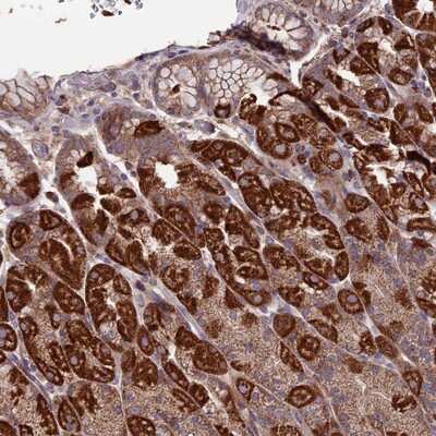 Immunohistochemistry-Paraffin SLC15A5 Antibody