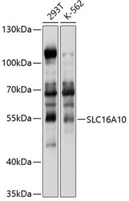 Western Blot: SLC16A10 Antibody [NBP3-05049] - Analysis of extracts of various cell lines, using SLC16A10 antibody at 1:1000 dilution. Secondary antibody: HRP Goat Anti-Rabbit IgG (H+L) at 1:10000 dilution. Lysates/proteins: 25ug per lane. Blocking buffer: 3% nonfat dry milk in TBST. Detection: ECL Basic Kit