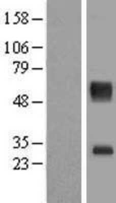 Western Blot: SLC16A11 Overexpression Lysate (Adult Normal) [NBL1-16014] Left-Empty vector transfected control cell lysate (HEK293 cell lysate); Right -Over-expression Lysate for SLC16A11.