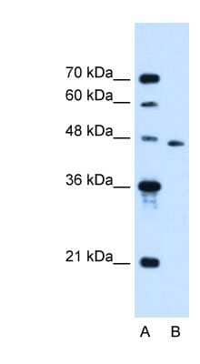 Western Blot: SLC16A12 Antibody [NBP1-59530] - Jurkat cell lysate, concentration 0.2-1 ug/ml.