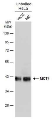 Western Blot: SLC16A3 Antibody [NBP3-13033] - Unboiled HeLa whole cell and membrane extracts (30 ug) were separated by 10% SDS-PAGE, and the membrane was blotted with SLC16A3 antibody (NBP3-13033) diluted at 1:1000. The HRP-conjugated anti-rabbit IgG antibody (NBP2-19301) was used to detect the primary antibody. (WCE: whole cell extract; ME: membrane extract)