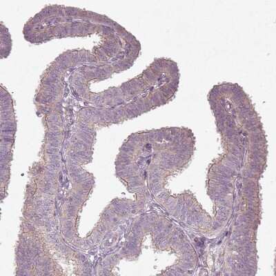 Immunohistochemistry-Paraffin: SLC16A9 Antibody [NBP2-31030] - Staining of human Fallopian tube shows weak positivity in apical membrane in glandular cells.