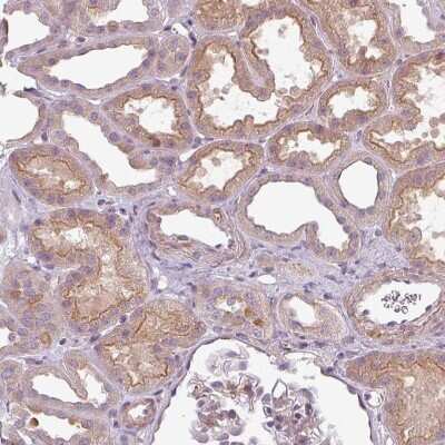 Immunohistochemistry-Paraffin: SLC16A9 Antibody [NBP2-31030] - Staining of human kidney shows moderate positivity in apical membrane in cells in tubules.