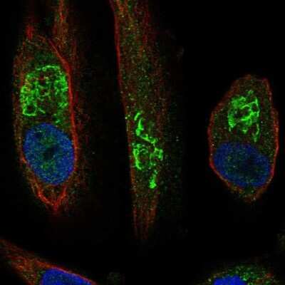 Immunocytochemistry/Immunofluorescence: SLC17A1/NPT Antibody [NBP2-55004] - Staining of human cell line RPTEC TERT1 shows localization to the Golgi apparatus.