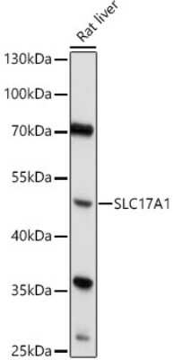 Western Blot: SLC17A1/NPT Antibody [NBP2-94745] - Western blot analysis of extracts of Rat liver, using SLC17A1/NPT antibody (NBP2-94745) at 1:1000 dilution. Secondary antibody: HRP Goat Anti-Rabbit IgG (H+L) at 1:10000 dilution. Lysates/proteins: 25ug per lane. Blocking buffer: 3% nonfat dry milk in TBST. Detection: ECL Basic Kit. Exposure time: 60s.