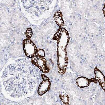 Immunohistochemistry-Paraffin: SLC17A2 Antibody [NBP1-82536] - Staining of human kidney shows strong cytoplasmic and membranous positivity in cells in tubules.