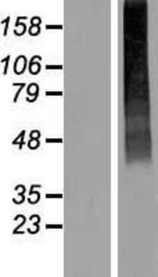 Western Blot: SLC17A2 Overexpression Lysate (Adult Normal) [NBL1-16020] Left-Empty vector transfected control cell lysate (HEK293 cell lysate); Right -Over-expression Lysate for SLC17A2.