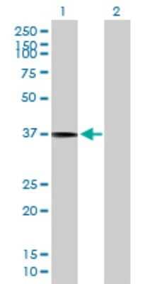 Western Blot: SLC17A3 Antibody [H00010786-B01P] - Analysis of SLC17A3 expression in transfected 293T cell line by SLC17A3 polyclonal antibody.  Lane 1: SLC17A3 transfected lysate(46.2 KDa). Lane 2: Non-transfected lysate.