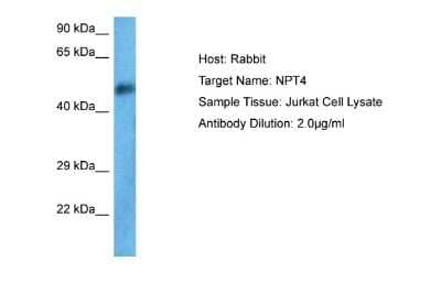 Western Blot: SLC17A3 Antibody [NBP2-86809] - Host: Rabbit. Target Name: SLC17A3. Sample Tissue: Human Jurkat Whole Cell. Antibody Dilution: 1.0ug/ml