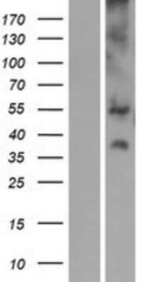 Western Blot: SLC17A3 Overexpression Lysate (Adult Normal) [NBP2-08311] Left-Empty vector transfected control cell lysate (HEK293 cell lysate); Right -Over-expression Lysate for SLC17A3.