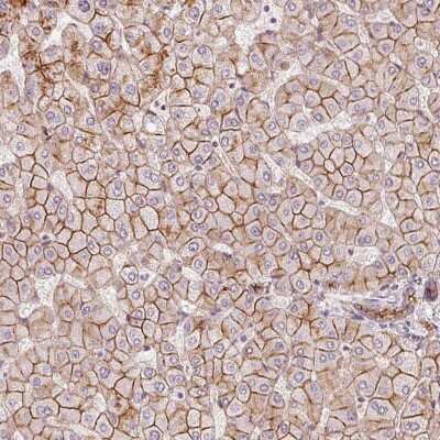 Immunohistochemistry-Paraffin SLC17A4 Antibody - BSA Free