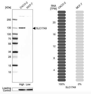 Western Blot: SLC17A9 Antibody [NBP2-30850] - Analysis in human cell lines Caco-2 and MCF-7 using Anti-SLC17A9 antibody. Corresponding SLC17A9 RNA-seq data are presented for the same cell lines. Loading control: Anti-GAPDH.