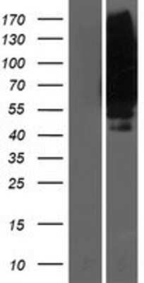 Western Blot Reduced Folate Carrier/SLC19A1 Overexpression Lysate