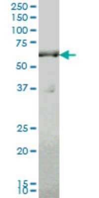 Western Blot: SLC19A2 Antibody (5B10) [H00010560-M10] - Analysis of SLC19A2 expression in A-431 (Cat # L015V1).