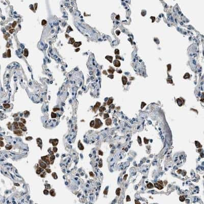 Immunohistochemistry-Paraffin: SLC19A2 Antibody [NBP1-86944] - Staining of human lung shows strong cytoplasmic positivity in macrophages.