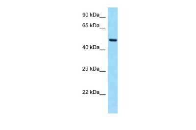 Western Blot: SLC19A2 Antibody [NBP2-88285] - WB Suggested Anti-SLC19A2 Antibody. Titration: 1.0 ug/ml. Positive Control: Fetal Heart