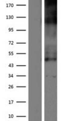 Western Blot: SLC19A2 Overexpression Lysate (Adult Normal) [NBP2-07548] Left-Empty vector transfected control cell lysate (HEK293 cell lysate); Right -Over-expression Lysate for SLC19A2.