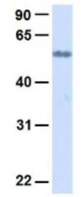 Western Blot: SLC19A3 Antibody [NBP1-69703] - Human Adult Placenta, Antibody Dilution: 1.0 ug/ml.