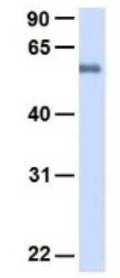 Western Blot: SLC19A3 Antibody [NBP1-69703] - Human Fetal Heart, Antibody Dilution: 1.0 ug/ml.