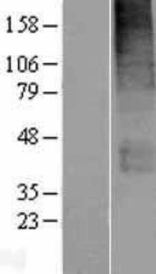 Western Blot: SLC19A3 Overexpression Lysate (Adult Normal) [NBP2-06216] Left-Empty vector transfected control cell lysate (HEK293 cell lysate); Right -Over-expression Lysate for SLC19A3.