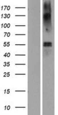 Western Blot: SLC1A3 Overexpression Lysate (Adult Normal) [NBP2-10257] Left-Empty vector transfected control cell lysate (HEK293 cell lysate); Right -Over-expression Lysate for SLC1A3.