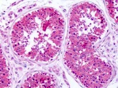 Immunohistochemistry-Paraffin: SLC1A4 Antibody [NBP1-44238] - Human, Testis: Formalin-Fixed Paraffin-Embedded (FFPE)