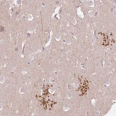 Immunohistochemistry-Paraffin: SLC1A4 Antibody [NBP2-38226] - Staining of human cerebral cortex shows strong membranous positivity in astrocytes.