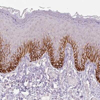 Immunohistochemistry-Paraffin: SLC1A4 Antibody [NBP2-38226] - Staining of human skin shows strong membranous positivity in a subset of squamous epithelial cells.