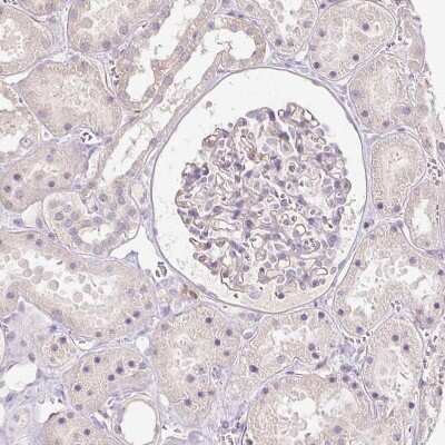 Immunohistochemistry-Paraffin: SLC1A4 Antibody [NBP2-38226] - Staining of human kidney shows no positivity in cells in glomeruli as expected.