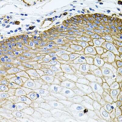 Immunohistochemistry-Paraffin: SLC1A4 Antibody [NBP2-95196] - Paraffin-embedded human esophagus using SLC1A4 .