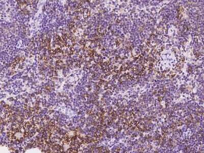 Immunohistochemistry-Paraffin: SLC1A4 Antibody [NBP2-97677] - Immunochemical staining of human SLC1A4 in human lymph node with rabbit polyclonal antibody at 1:500 dilution, formalin-fixed paraffin embedded sections.