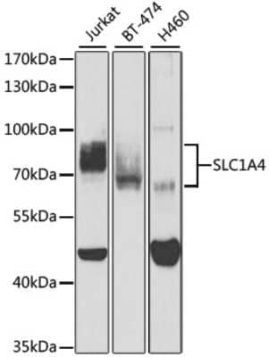Western Blot: SLC1A4 Antibody [NBP2-95196] - Analysis of extracts of various cell lines, using SLC1A4 at 1:400 dilution. Secondary antibody: HRP Goat Anti-Rabbit IgG (H+L) at 1:10000 dilution. Lysates/proteins: 25ug per lane. Blocking buffer: 3% nonfat dry milk in TBST. Detection: ECL Basic Kit . Exposure time: 60s.